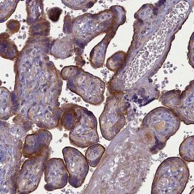 Immunohistochemistry-Paraffin: PLEKHG6 Antibody [NBP1-83840] - Staining of human placenta shows strong membranous staining positivity in trophoblastic cells.