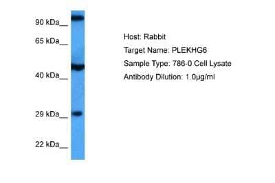 Western Blot: PLEKHG6 Antibody [NBP2-85493] - Host: Rabbit. Target Name: PLEKHG6. Sample Tissue: Human 786-0 Whole Cell lysates. Antibody Dilution: 1ug/ml