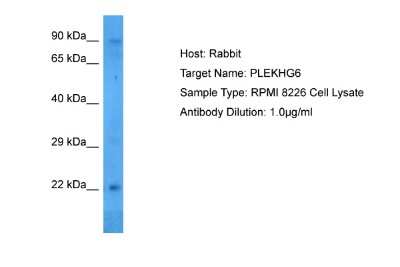 Western Blot: PLEKHG6 Antibody [NBP2-85494] - Host: Rabbit. Target Name: PLEKHG6. Sample Tissue: Human RPMI 8226 Whole Cell. Antibody Dilution: 1.0ug/ml