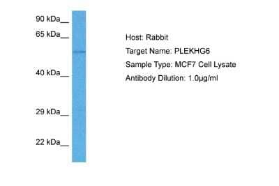 Western Blot: PLEKHG6 Antibody [NBP2-85495] - Host: Rabbit. Target Name: PLEKHG6. Sample Tissue: Human MCF7 Whole Cell lysates. Antibody Dilution: 1ug/ml