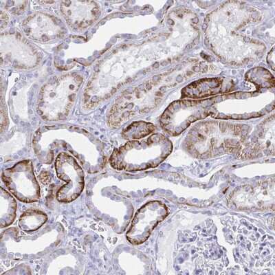 Immunohistochemistry PLEKHH1 Antibody - BSA Free