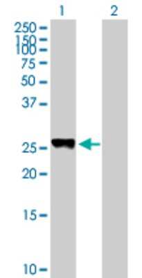 Western Blot: PLEKHM1P Antibody [H00440456-B01P] - Analysis of PLEKHM1P expression in transfected 293T cell line by PLEKHM1P polyclonal antibody.  Lane 1: LOC440456 transfected lysate(26.07 KDa). Lane 2: Non-transfected lysate.