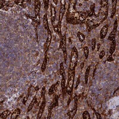 Immunohistochemistry-Paraffin PLEKHO2 Antibody - BSA Free