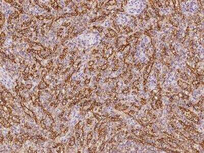 Immunohistochemistry-Paraffin: PLEKHO2 Antibody [NBP3-06325] - Immunochemical staining of human PLEKHO2 in human spleen with rabbit polyclonal antibody at 1:100 dilution, formalin-fixed paraffin embedded sections.
