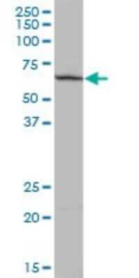 Western Blot: PLEKHO2 Antibody [H00080301-B01P] - Analysis of pp9099 expression in human placenta.