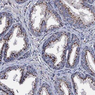Immunohistochemistry-Paraffin: PLET-1 Antibody [NBP1-90680] - Staining of human prostate shows strong cytoplasmic positivity in glandular cells.