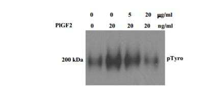 Western Blot: PLGF Antibody (9G33) [NBP2-21953] - Mouse skin endothelial cells (SENDs) were treated with or   without PlGF2 (20ng/ml) in the absence or presence of 5 or   20 ug/ml Rat monoclonal blocking antibody of mouse PlGF   for 30 mins and the phospho-VEGFR1 was detected with IP-Western for pTyrosine.