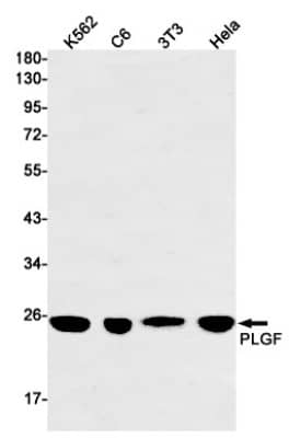 Western Blot: PLGF Antibody (S08-9C2) [NBP3-20019] - Western blot detection of PLGF in K562, C6, 3T3, Hela cell lysates using NBP3-20019 (1:1000 diluted). Predicted band size: 25kDa. Observed band size: 25kDa.