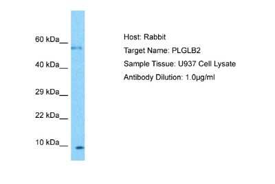 Western Blot: PLGLB2 Antibody [NBP2-84221] - Host: Rabbit. Target Name: PLGLB2. Sample Type: U937 Whole Cell lysates. Antibody Dilution: 1.0ug/ml