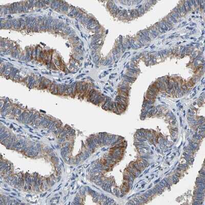 Immunohistochemistry-Paraffin: PLGRKT Antibody [NBP1-89254] - Staining of human Fallopian tube shows moderate cytoplasmic/membranous positivity in glandular cells.