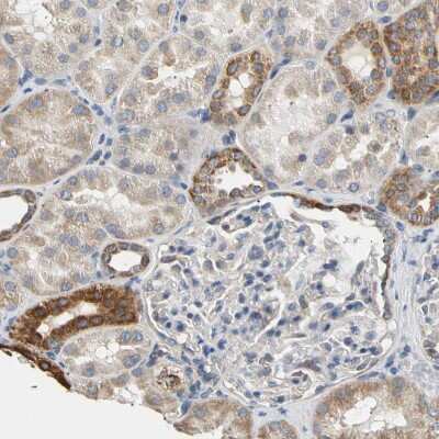 Immunohistochemistry-Paraffin: PLGRKT Antibody [NBP1-89254] - Staining of human kidney shows moderate cytoplasmic positivity in cells in distal tubules.