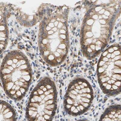 Immunohistochemistry-Paraffin: PLGRKT Antibody [NBP1-89254] - Staining of human rectum shows moderate cytoplasmic/membranous positivity in glandular cells.