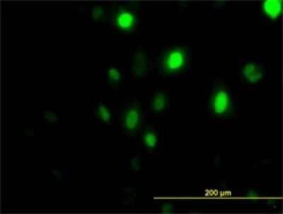 Immunocytochemistry/Immunofluorescence: PLK1 Antibody (2G12) [H00005347-M01] - Analysis of monoclonal antibody to PLK1 on HeLa cell. Antibody concentration 10 ug/ml.