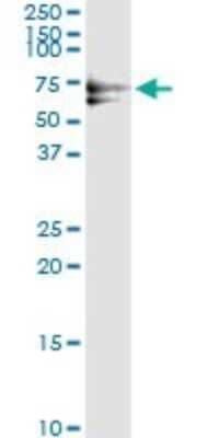 Immunoprecipitation: PLK1 Antibody (2G12) [H00005347-M01] - Analysis of PLK1 transfected lysate using anti-PLK1 monoclonal antibody and Protein A Magnetic Bead, and immunoblotted with PLK1 MaxPab rabbit polyclonal antibody.