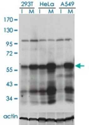 Western Blot: PLK1 Antibody (2G12) [H00005347-M01] - Analysis of PLK1 in extracts from 293T, HeLa and A549 cell using anti-PLK1 monoclonal antibody.