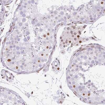 Immunohistochemistry-Paraffin: PLK1 Antibody [NBP2-49014] - Staining of human testis shows moderate nuclear positivity in cells in seminiferous ducts and Leydig cells.