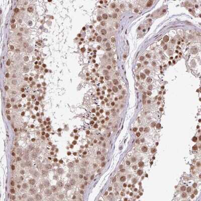Immunohistochemistry-Paraffin: PLK1 Antibody [NBP2-49074] - Staining of human testis shows nuclear positivity in cells in seminiferous ducts and Leydig cells.