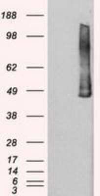 Western Blot: PLK1 Antibody (OTI1D4) - Azide and BSA Free [NBP2-73472] - HEK293T cells were transfected with the pCMV6-ENTRY control (Left lane) or pCMV6-ENTRY PLK1 (Right lane) cDNA for 48 hrs and lysed. Equivalent amounts of cell lysates (5 ug per lane) were separated by SDS-PAGE and immunoblotted with anti-PLK1.