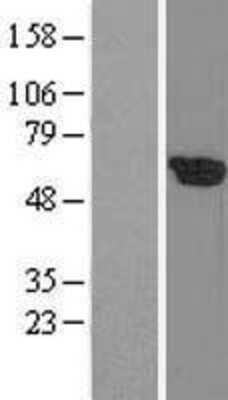 Western Blot: PLK1 Overexpression Lysate (Adult Normal) [NBL1-14515] Left-Empty vector transfected control cell lysate (HEK293 cell lysate); Right -Over-expression Lysate for PLK1.