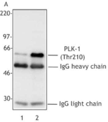 Western Blot: PLK1 [p Thr210] Antibody (2A3) [NBP1-02851] - Western blot using PLK1 [p Thr210] Antibody (2A3)