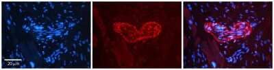 Immunohistochemistry-Paraffin: PLK2 Antibody [NBP2-84222] - Rabbit Anti-PLK2 Antibody. Formalin Fixed Paraffin Embedded Tissue: Human heart Tissue. Observed Staining: Cytoplasmic in endothelial cells in blood vessels. Primary Antibody Concentration: N/A. Other Working Concentrations: 1:600. Secondary Antibody: Donkey anti-Rabbit-Cy3. Secondary Antibody Concentration: 1:200. Magnification: 20X. Exposure Time: 0.5 - 2.0 sec
