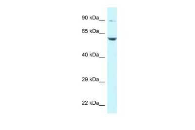 Western Blot: PLK2 Antibody [NBP2-84222] - WB Suggested Anti-PLK2 Antibody. Titration: 1.0 ug/ml. Positive Control: Jurkat Whole Cell