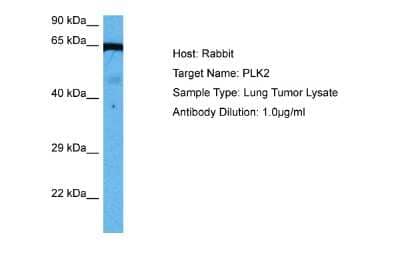 Western Blot: PLK2 Antibody [NBP2-84223] - Host: Rabbit. Target Name: PLK2. Sample Tissue: Human Lung Tumor lysates. Antibody Dilution: 1ug/ml