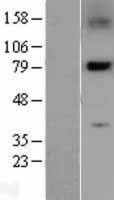 Western Blot: PLK2 Overexpression Lysate (Adult Normal) [NBL1-14516] Left-Empty vector transfected control cell lysate (HEK293 cell lysate); Right -Over-expression Lysate for PLK2.