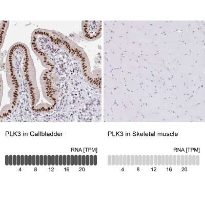 Immunohistochemistry-Paraffin: PLK3 Antibody [NBP2-32530] - Analysis in human gallbladder and skeletal muscle tissues using NBP2-32530 antibody. Corresponding PLK3 RNA-seq data are presented for the same tissues.