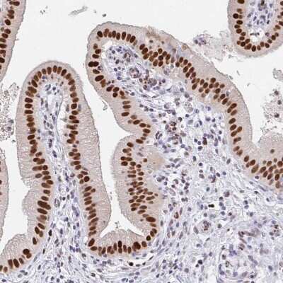Immunohistochemistry-Paraffin: PLK3 Antibody [NBP2-32530] - Staining of human gallbladder shows strong nuclear positivity in glandular cells.