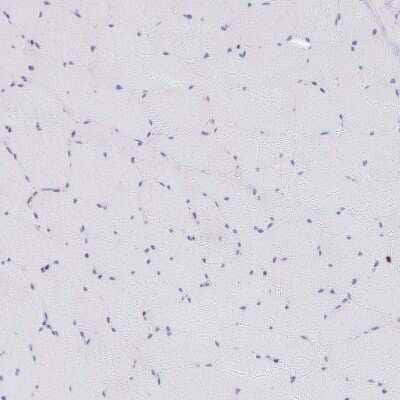 Immunohistochemistry-Paraffin: PLK3 Antibody [NBP2-32530] - Staining of human skeletal muscle shows no positivity in myocytes as expected.