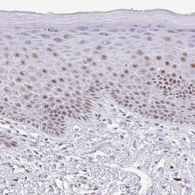 Immunohistochemistry-Paraffin: PLK3 Antibody [NBP2-32530] - Staining of human skin shows moderate nuclear positivity in squamous epithelial cells.