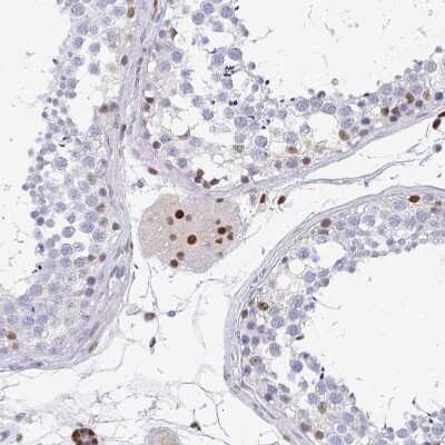Immunohistochemistry-Paraffin: PLK3 Antibody [NBP2-32530] - Staining of human testis shows strong nuclear positivity in Leydig cells.