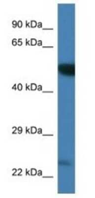 Western Blot: PLK3 Antibody [NBP1-74248] - Mouse Brain Lysate 1ug/ml  Gel Concentration 12%