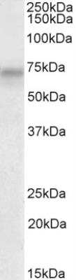 Western Blot: PLK3 Antibody [NBP2-26197] - Staining of HeLa lysate (35 ug protein in RIPA buffer). Primary incubation was 1 hour. Detected by chemiluminescence.  