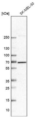 Western Blot: PLK3 Antibody [NBP2-32530] - Analysis in human cell line SK-MEL-30.