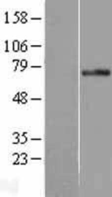 Western Blot: PLK3 Overexpression Lysate (Adult Normal) [NBL1-14517] Left-Empty vector transfected control cell lysate (HEK293 cell lysate); Right -Over-expression Lysate for PLK3.