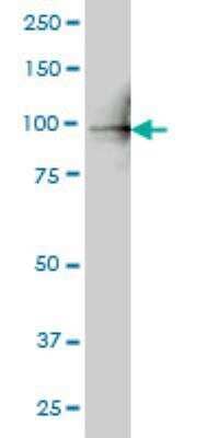 Western Blot: PLK4 Antibody (1C8) [H00010733-M01] - Western Blot analysis of PLK4 expression in Hela NE ( Cat # L013V3 ).