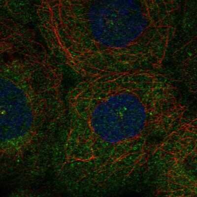 Immunocytochemistry/Immunofluorescence: PLK4 Antibody [NBP2-55088] - Staining of human cell line A-431 shows localization to cytosol & centrosome.