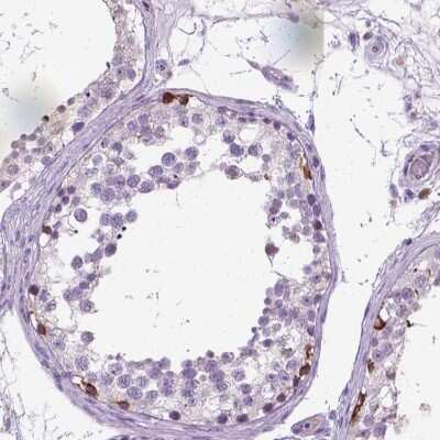 Immunohistochemistry: PLK4 Antibody [NBP2-68650] - Immunohistochemical staining of human testis shows strong cytoplasmic positivity in spermatogonia.