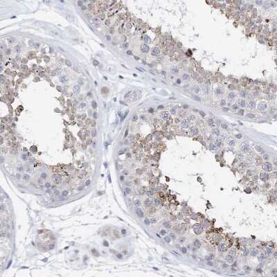 Immunohistochemistry-Paraffin: PLK4 Antibody [NBP1-87095] - Staining of human testis shows moderate cytoplasmic positivity in cells in seminiferous ducts.