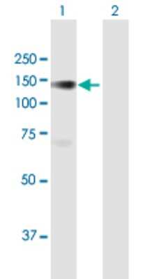 Western Blot: PLK4 Antibody [H00010733-B01P] - Analysis of PLK4 expression in transfected 293T cell line by PLK4 polyclonal antibody.  Lane 1: PLK4 transfected lysate(106.7 KDa). Lane 2: Non-transfected lysate.