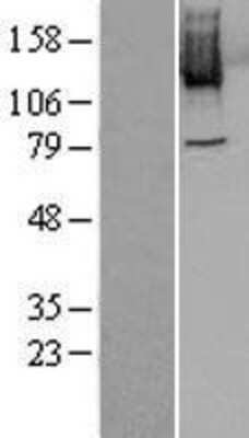 Western Blot: PLK4 Overexpression Lysate (Adult Normal) [NBL1-14518] Left-Empty vector transfected control cell lysate (HEK293 cell lysate); Right -Over-expression Lysate for PLK4.