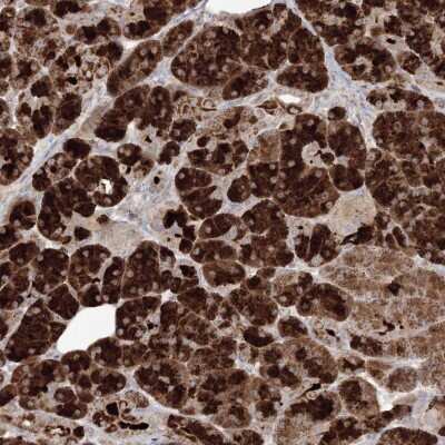 Immunohistochemistry: PLK5 Antibody [NBP2-48630] - Staining of human pancreas shows strong cytoplasmic positivity in exocrine glandular cells.