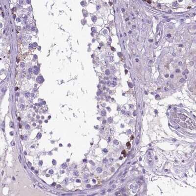 Immunohistochemistry-Paraffin: PLK5 Antibody [NBP2-48630] - Staining of human testis shows high expression.