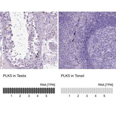 <b>Orthogonal Strategies Validation. </b>Immunohistochemistry-Paraffin: PLK5 Antibody [NBP2-48630] - Staining in human testis and tonsil tissues using anti-PLK5 antibody. Corresponding PLK5 RNA-seq data are presented for the same tissues.