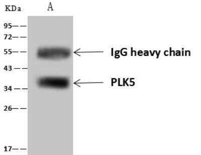 Immunoprecipitation: PLK5 Antibody [NBP3-12602] - Lane A:0.5 mg Hela Whole Cell Lysate4 uL anti-PLK5 rabbit polyclonal antibody and 60 ug of Immunomagnetic beads Protein A/G.Primary antibody:Anti-PLK5 rabbit polyclonal antibody,at 1:100 dilution Secondary antibody:Goat Anti-Rabbit IgG (H+L)/HRP at 1/10000 dilutionDeveloped using the ECL technique.Performed under reducing conditions.Predicted band size: 36 kDaObserved band size :36 kDa