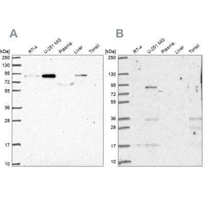 <b>Independent Antibodies Validation. </b>Western Blot: PLOD1 Antibody [NBP2-31885] - Analysis using Anti-PLOD1 antibody NBP2-31885 (A) shows similar pattern to independent antibody NBP2-38770 (B).