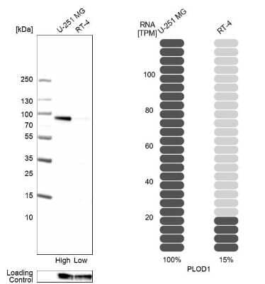 Western Blot: PLOD1 Antibody [NBP2-31885] - Analysis in human cell line U-251 MG and human cell line RT-4.