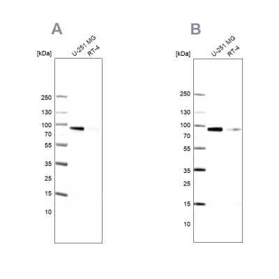 Western Blot: PLOD1 Antibody [NBP2-31885] - Analysis NBP2-31885 (A) shows similar pattern to independent antibody NBP2-38770 (B).